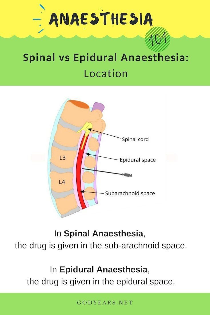 Types of Regional Anaesthesia