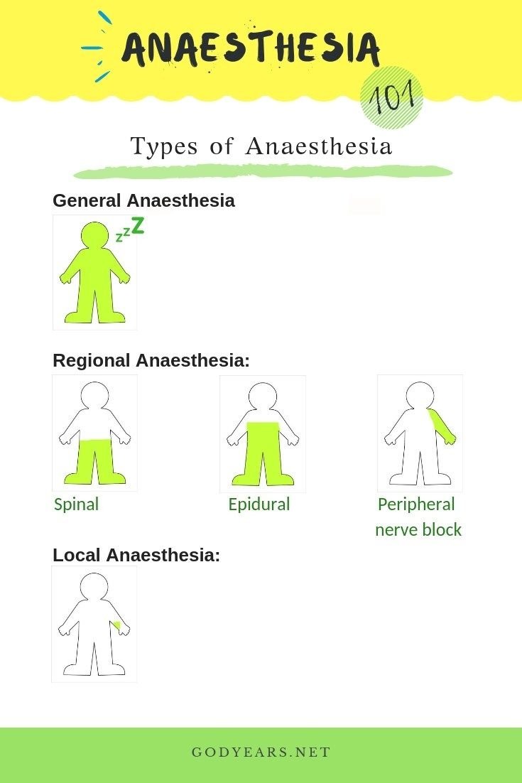 Types of Anaesthesia